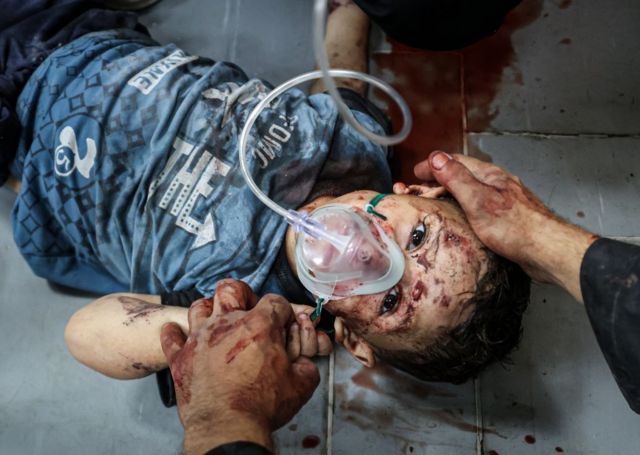 Un niño herido en Gaza.