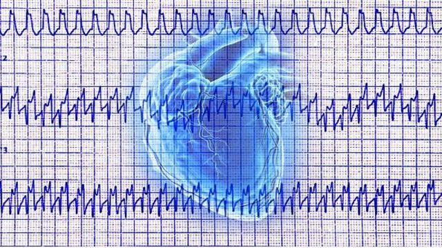 மாரடைப்பு, உடற்பயிற்சி, கோவிட்