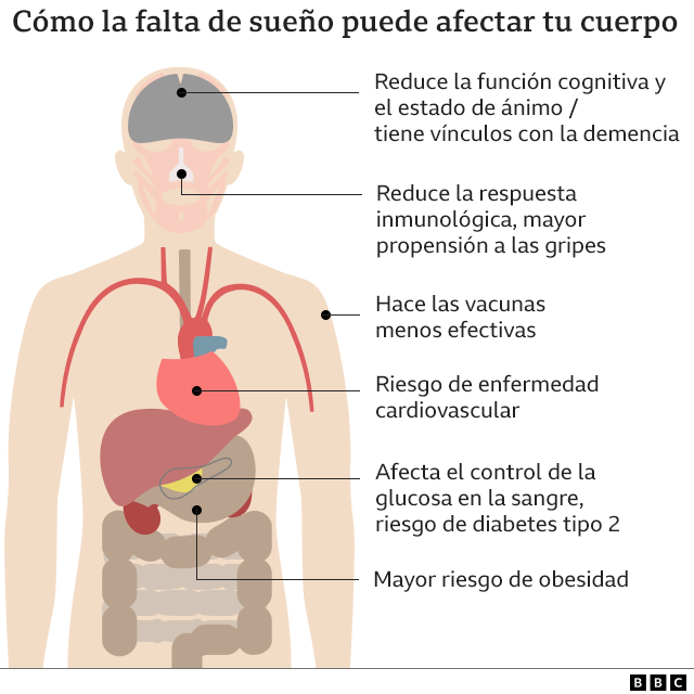 Gráfico muestra el riesgos de no dormir bien