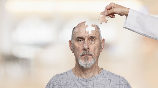 Man with puzzle figure in brain