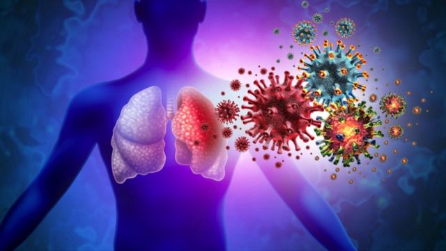 Infection pulmonaire à triple virus et tridemic Infection pulmonaire humaine et maladie inflammatoire respiratoire comme l'épidémie de grippe ou la pneumonie et la maladie inflammatoire pulmonaire avec des éléments d'illustration en 3D.