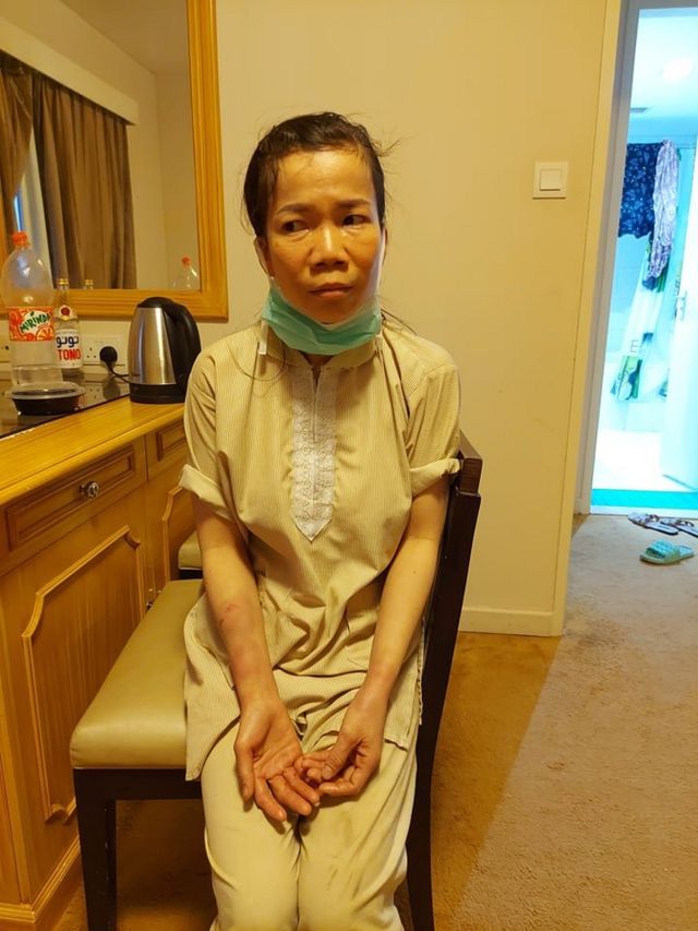 Một nạn nhân Việt Nam bị đánh đập tại Saudi Arabia