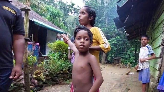 ஊட்டச்சத்துக் குறைபாடு