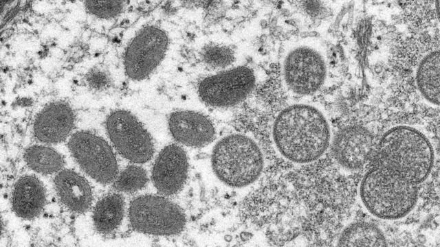 CRÉDITO,CDC/REUTERS. O monkeypox visto em microscópio eletrônico