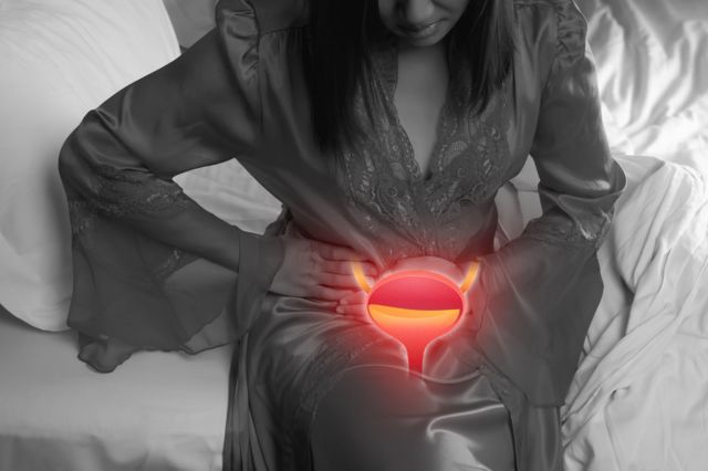 Ilustración de una mujer con una infección urinaria