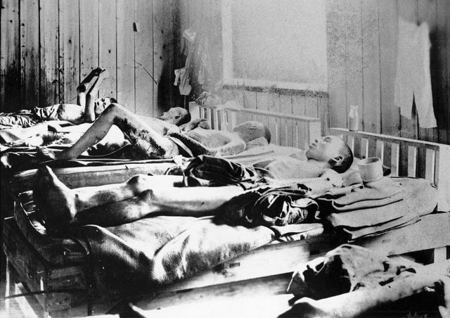 जापान के हिरोशिमा में अमेरिकी परमाणु हमले के बाद बचे लोग, 1945