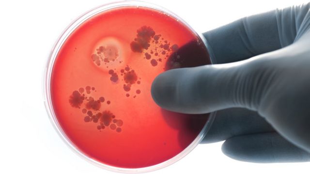 Placa com cultura de bactérias
