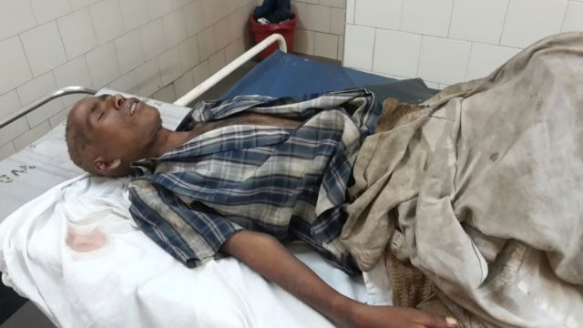 遺体安置所で生きていたインド人男性 2日後に死亡 cニュース