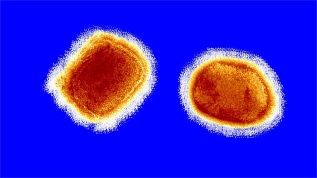 「サル痘」の感染報告、欧米などで相次ぐ 保健当局が調査 - BBCニュース