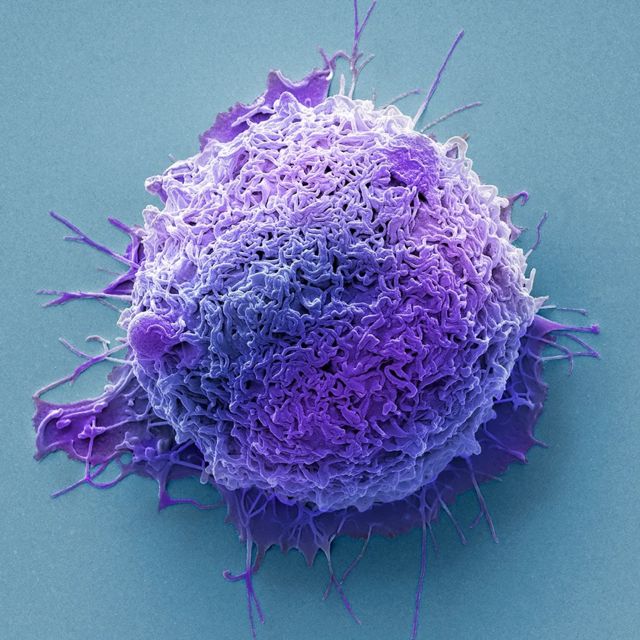 உடலில் ஏற்படும் கட்டிகளுக்குள் வாழும் நுண்ணுயிரிகளின் மர்மம்