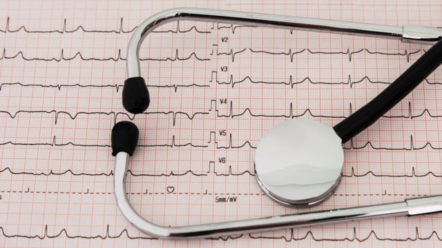 Estetoscópio e gráfico de cardiologia (foto de arquivo)
