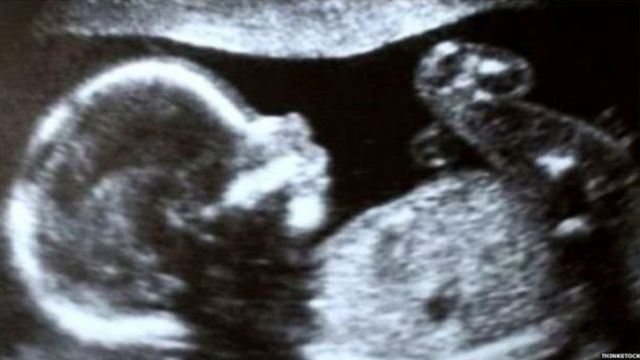 मैं 1 महीने की गर्भवती हूं और मुझे यह बच्चा नहीं चाहिए कौन सी गोलियां?