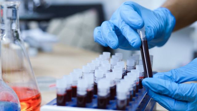 Fotografia mostra uma mão com luva mexendo em amostras de um líquido vermelho sangue em um laboratório