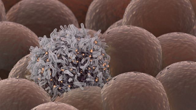 خلايا سرطانية