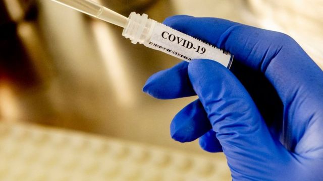 koronavirus testi