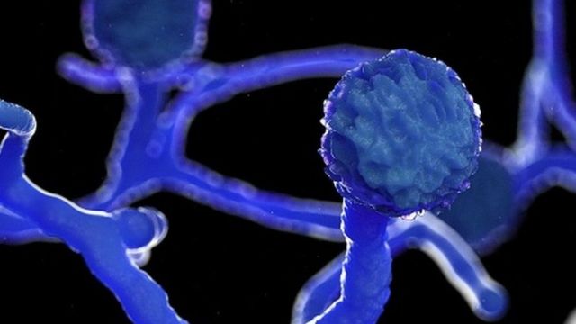 Mucormicosis, el peligroso "hongo negro" que afecta a pacientes de covid-19  en India - BBC News Mundo
