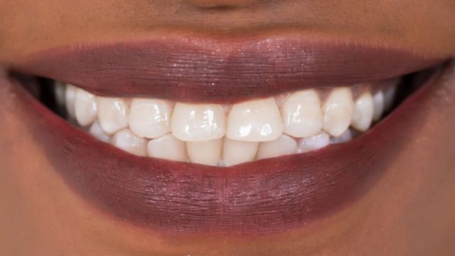 علاج جديد" قد يضع حدا لعمليات حشو الأسنان - BBC News عربي
