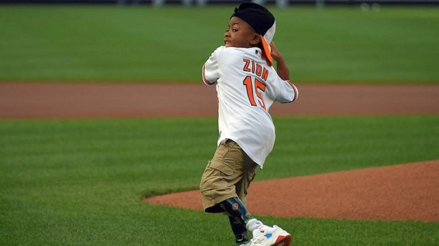 Zion Harvey lanzando una bola de baseball.