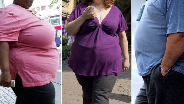Los países de América Latina donde más ha crecido la obesidad - BBC News Mundo