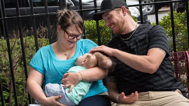 Sierrra y Dustin no lograban entender cómo su bebé podía usar el cerebro, a pesar de que estuviera fuera de su cráneo.