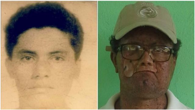Deíde Freire de Andrade a los 18 años y ahora.