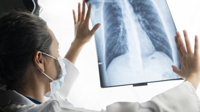 Radiografia pulmones