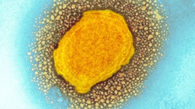 Partícula do vírus da varíola dos macacos, micrografia eletrônica de transmissão colorida (TEM)