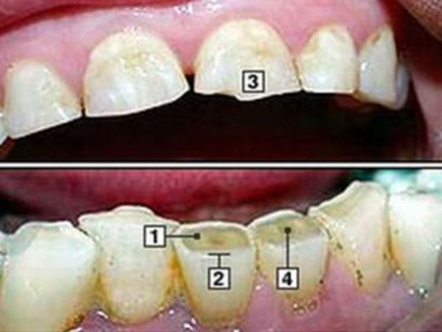 O que fazer quando o paciente não sabe onde está doendo? – Dental