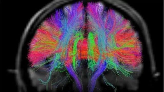 தற்போதைய செயற்கை நுண்ணறிவு அமைப்புகளை விட மனித மூளை தன்னை தகவமைத்துக் கொள்ள கூடியது; வேகமாக கற்றுக் கொள்கிறது.