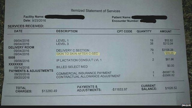 Hospital bill posted on Imgur