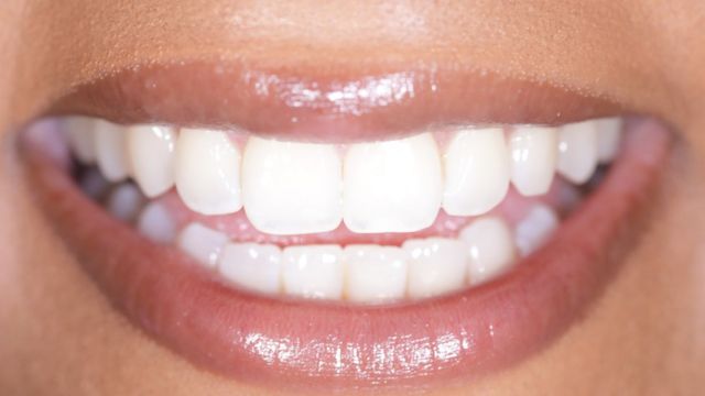 white and straight teeth