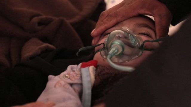 La pequeña Gulbadan con una máscara de oxígeno que le sostiene su padre.