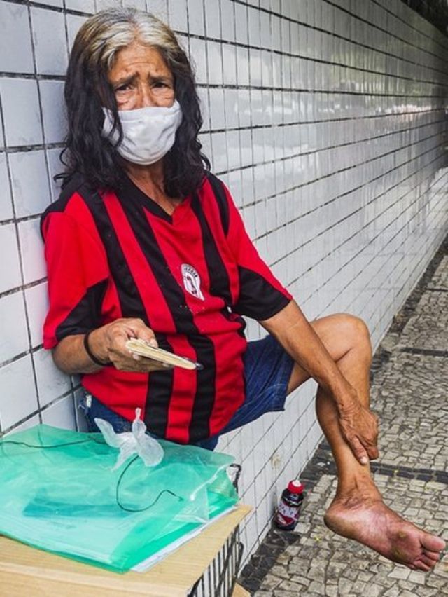 Una mujer muestra los callos de sus pies