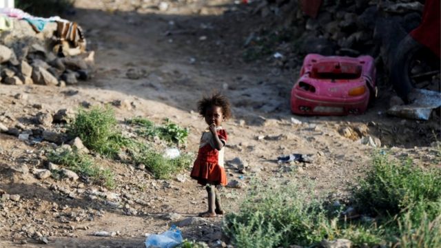 طفلة نازحة شردتها الحرب في اليمن