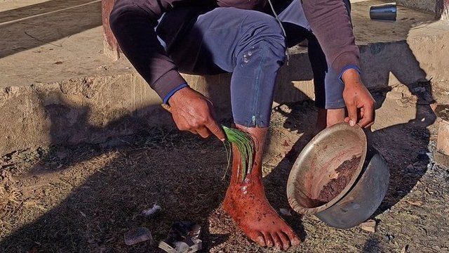 जडीबुटी