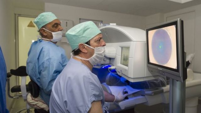 Cirujanos usando láser para una operación de ojos