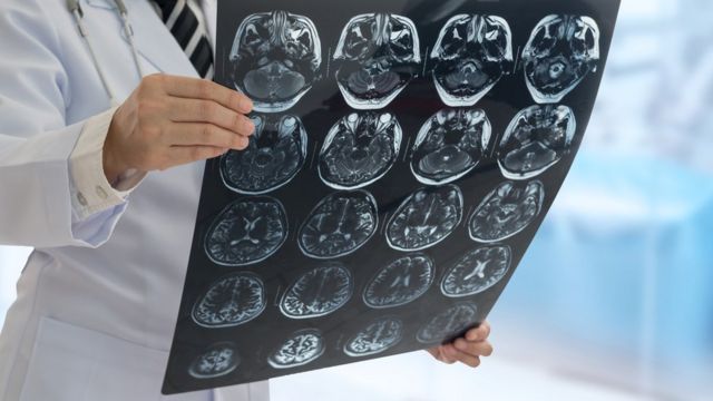 Médico con tomografías cerebrales