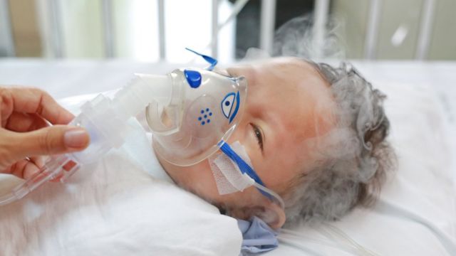 Virus respiratorio sincitial: la enfermedad respiratoria que preocupa a los  pediatras (y no es el coronavirus) - BBC News Mundo