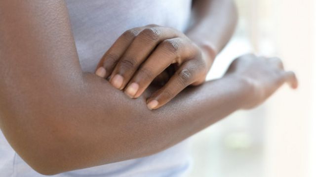 Brazos de una mujer negra.