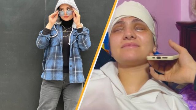 البلوغر المصرية سارة محمد التي فقدت بصرها .. ماذا تقول؟
