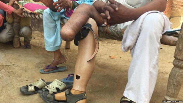 લિકાયતે રમખાણમાં પોતાનો પગ ગુમાવ્યો છે
