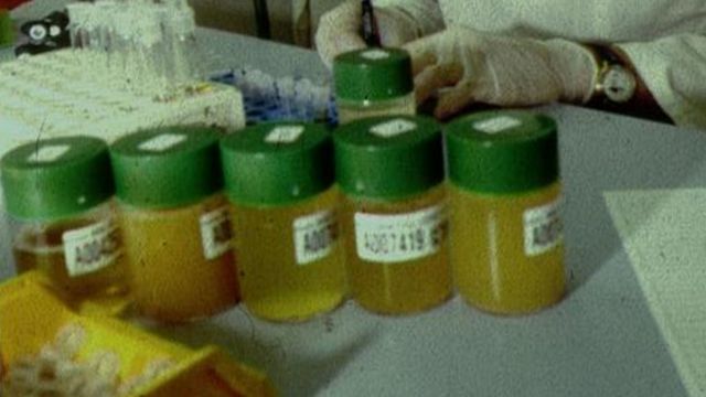 Образцы мочи для анализа