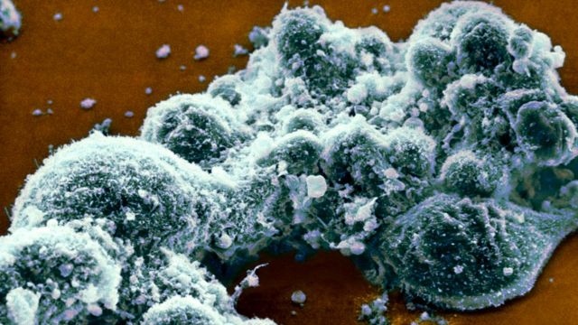 Вирус герпеса делает мышей - и, очень возможно, людей - менее подверженными некоторым бактериальным инфекциям