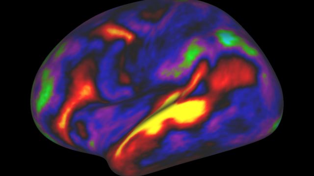 Mapa de actividad del cerebro