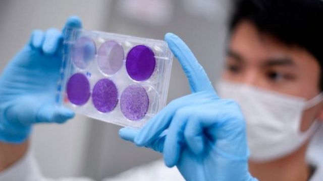 கொரோனா வைரஸ்