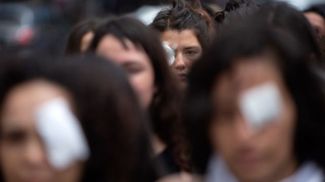 Una protesta de mujeres en Chile contra el uso de las balas de goma durante las manifestaciones.