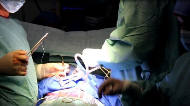 Au Mali, les premières opérations consistant "à arrêter le cœur, enlever une valve malade et la remplacer par une valve synthétique" ont eu lieu en septembre 2016.