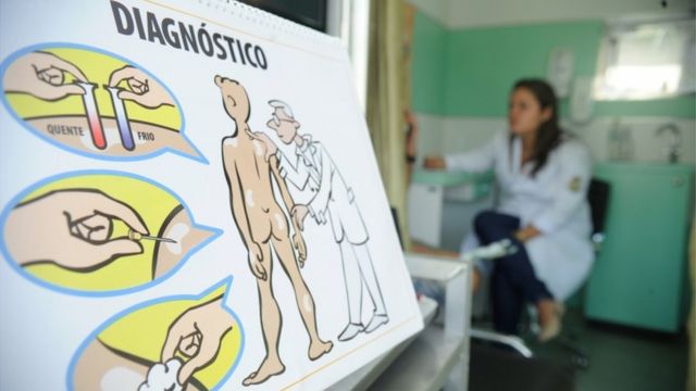 Saiba identificar os sintomas da Hanseníase, doença que registra mais de 26  mil novos casos ao ano no país