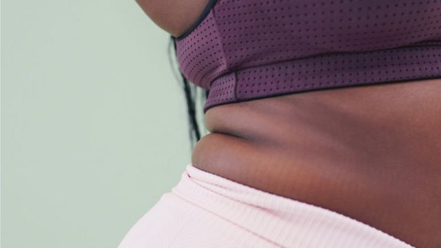 امرأة تظهر تراكم الدهون في منطقة الخصر