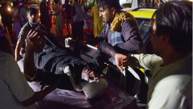 Medical and hospital staff bring an injured man on a stretcher for treatment